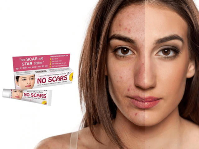 skin care