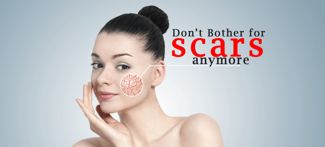 No Scar cream