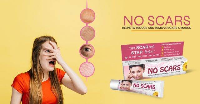 creams to prevent acne scars