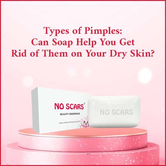 scars soap cost