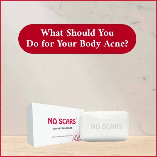 https://www.noscars.co.in/wp-content/uploads/2022/04/What-Should-You-Do-for-Your-Body-Acne.jpg