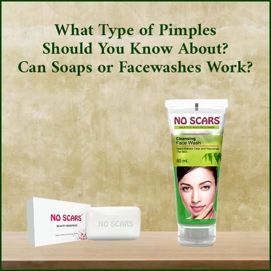 no scars soap for pimples