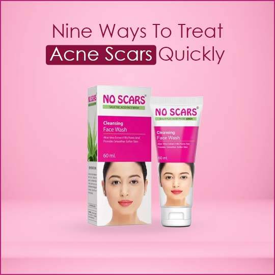 https://www.noscars.co.in/wp-content/uploads/2022/05/Nine-ways-to-treat-acne-scars-quickly.jpg