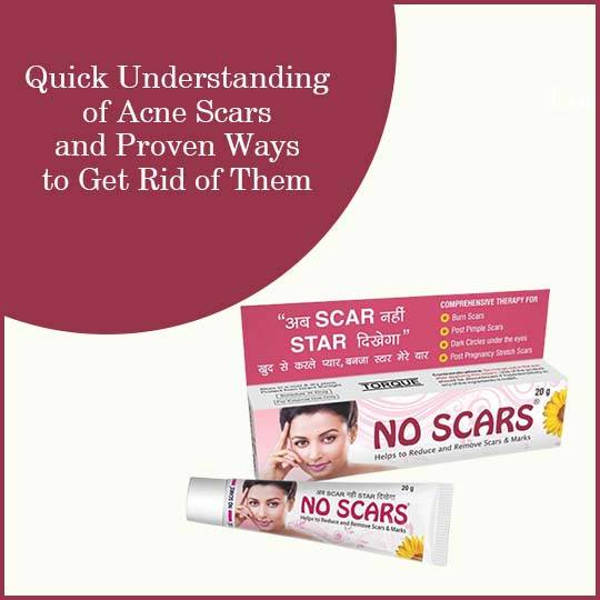 https://www.noscars.co.in/wp-content/uploads/2022/05/Quick-Understanding-of-Acne-Scars-and-Proven-Ways-to-Get-Rid-of-Them.jpg