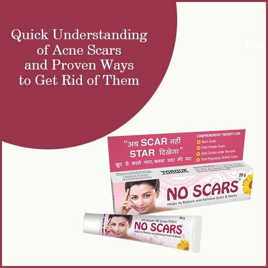 https://www.noscars.co.in/wp-content/uploads/2022/05/Quick-Understanding-of-Acne-Scars-and-Proven-Ways-to-Get-Rid-of-Them.jpg