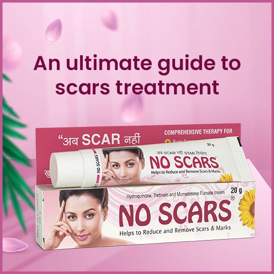 https://www.noscars.co.in/wp-content/uploads/2022/06/All-you-need-to-know-about-Acne-and-its-Treatment.jpg