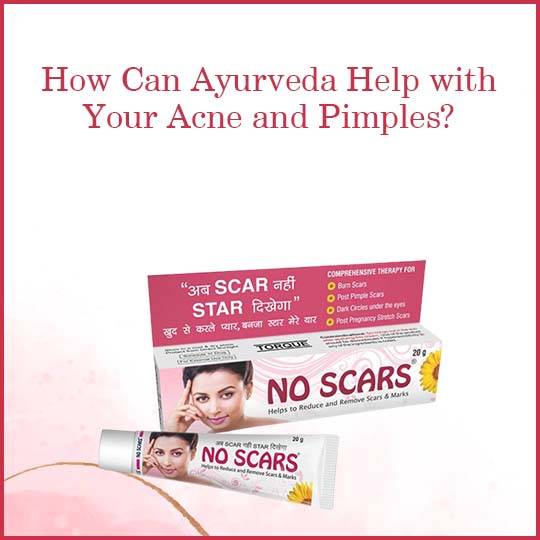 https://www.noscars.co.in/wp-content/uploads/2022/06/How-Can-Ayurveda-Help-with-Your-Acne-and-Pimples.jpg