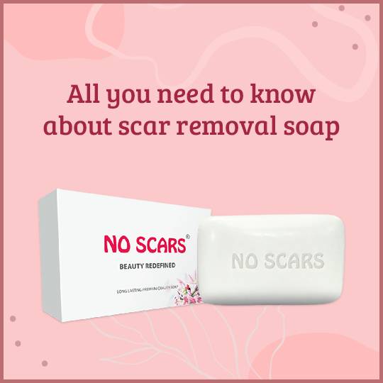 https://www.noscars.co.in/wp-content/uploads/2022/07/All-you-need-to-know-about-scar-removal-soap.jpg