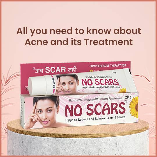 An ultimate guide to scars treatment