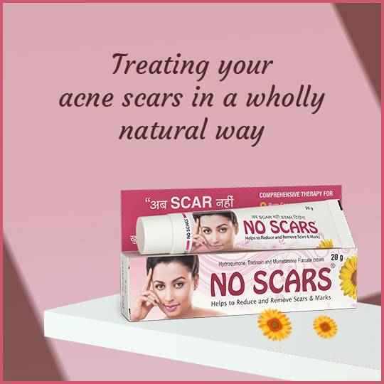 https://www.noscars.co.in/wp-content/uploads/2022/08/Treating-your-acne-scars-in-a-wholly-natural-way.jpg