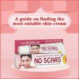 No scars cream for pimples